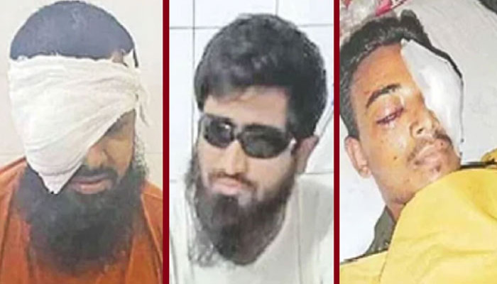 আন্দোলনে গুলিতে চোখ হারিয়েছেন ৪০১ জন