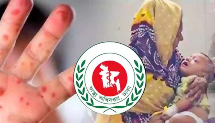 হাম উপসর্গে আরও ৮ জনের মৃত্যু